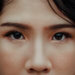 Cuanto cuesta una operación de nariz