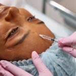 Infiltraciones de ácido hialurónico en la cara